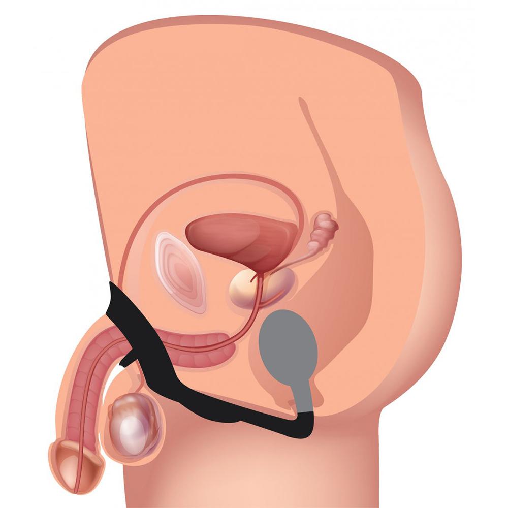 10X P-Bomb Silicone Cock and Ball Ring with Vibrating Anal Plug 10X P-Bomb Silicone Cock and Ball Ring with Vibrating Anal Plug